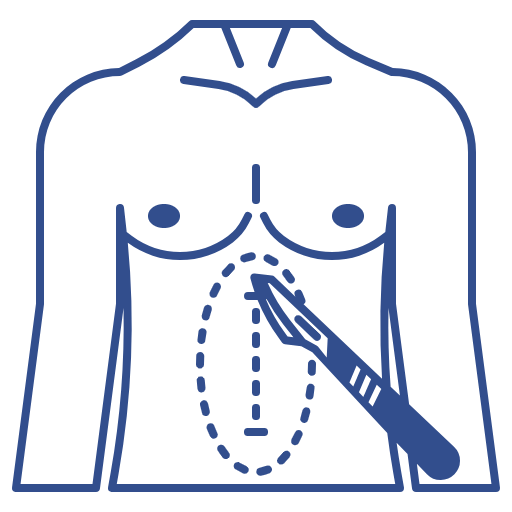Laparoscopic Surgery