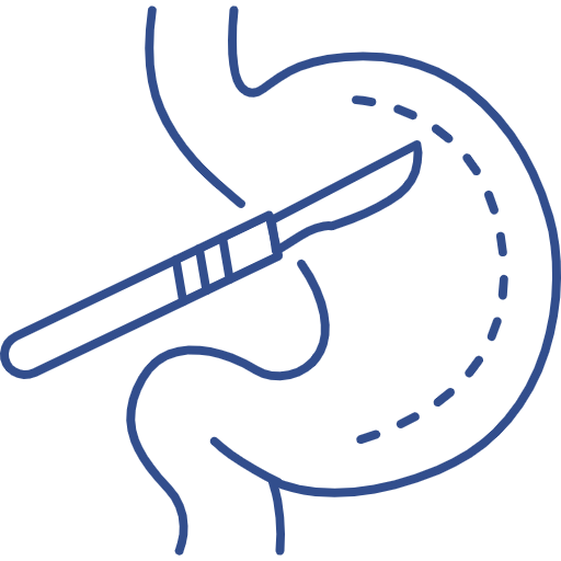 Bariatric Surgery